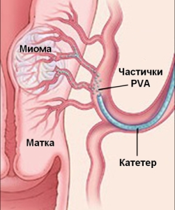 Рисунок: /images/rhir-1.jpg